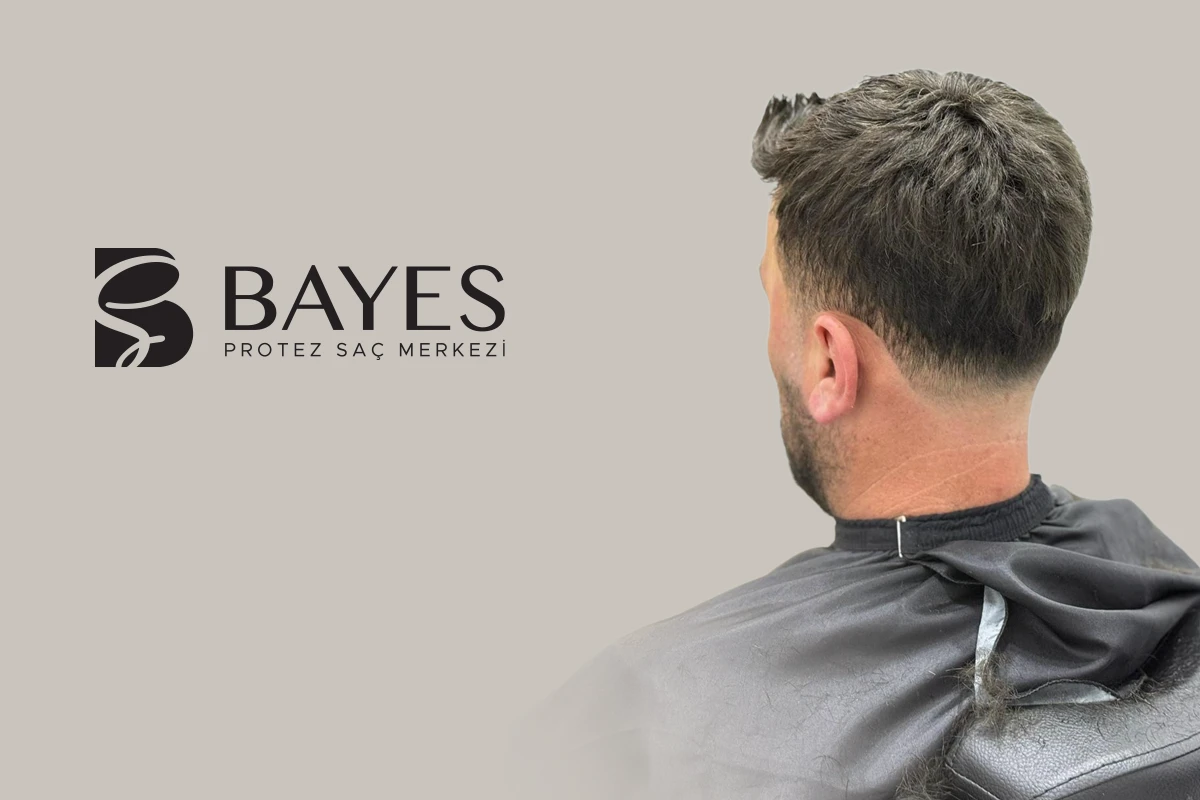Bantsız Protez Saç