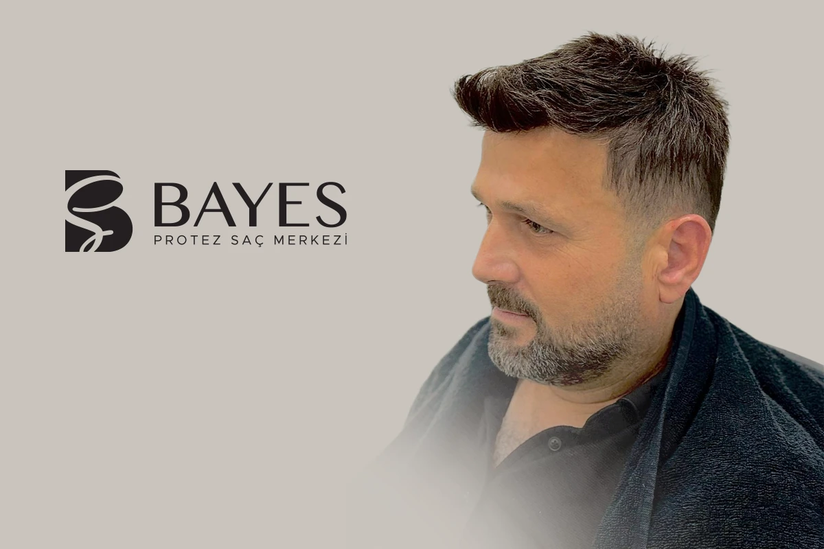 Protez Saç Fiyatları