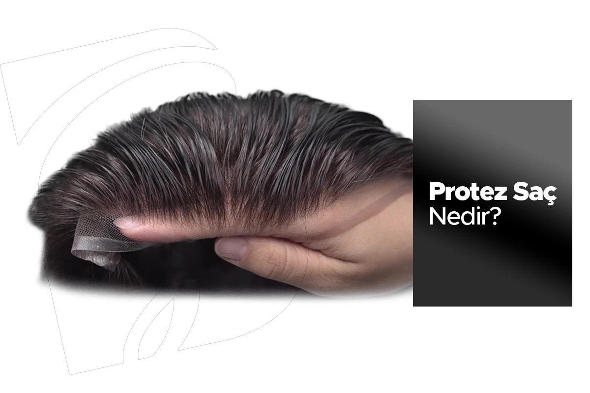 Erkek Protez Saç Nedir