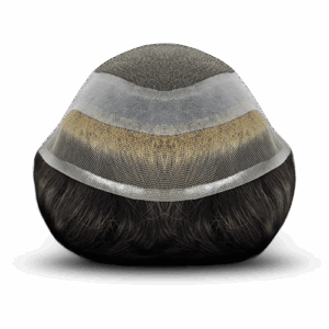 Ankara 2 Modeli Protez Saç