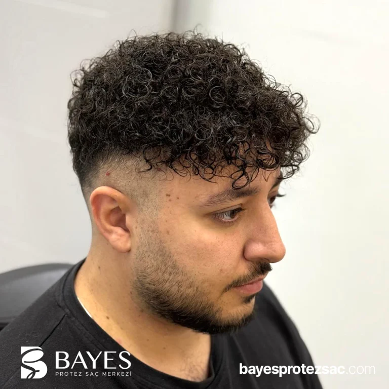 Bölgesel Protez Saç