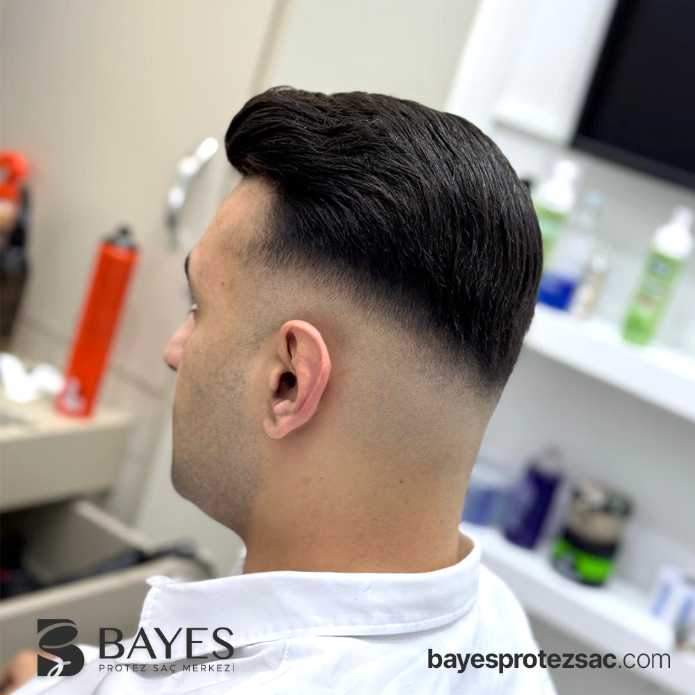 Bölgesel Protez Saç