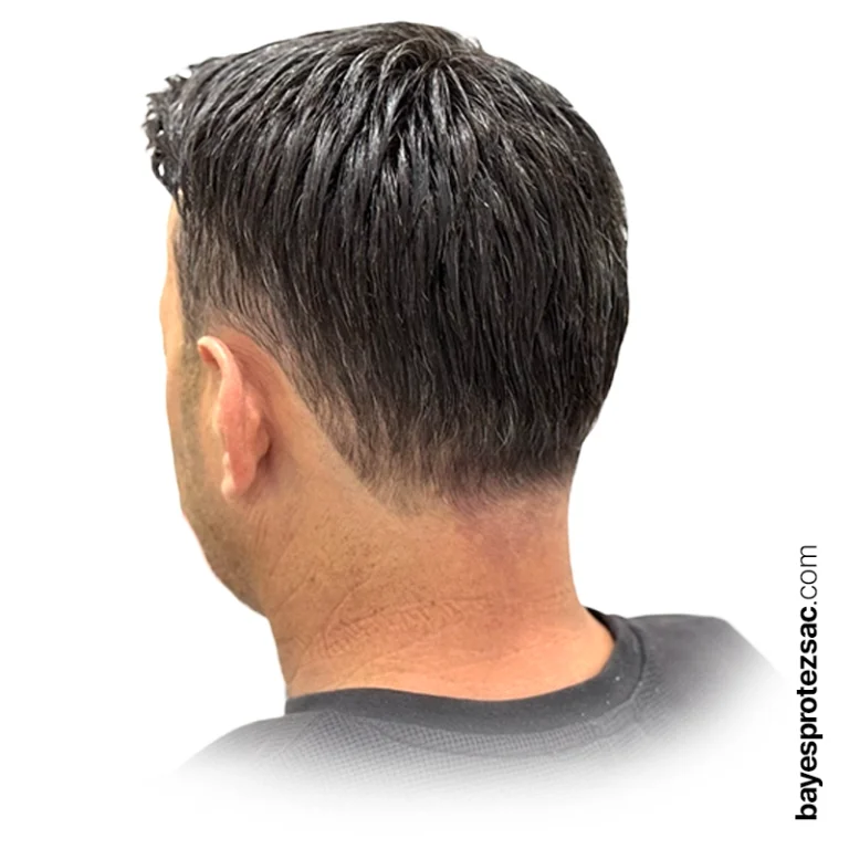Erkek Protez Saç Nedir? - Bayes Protez Saç Merkezi - Pendik Protez Saç
