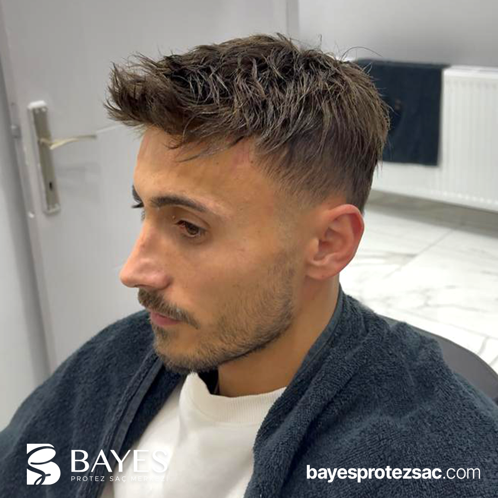 Protez Saç Bakımı