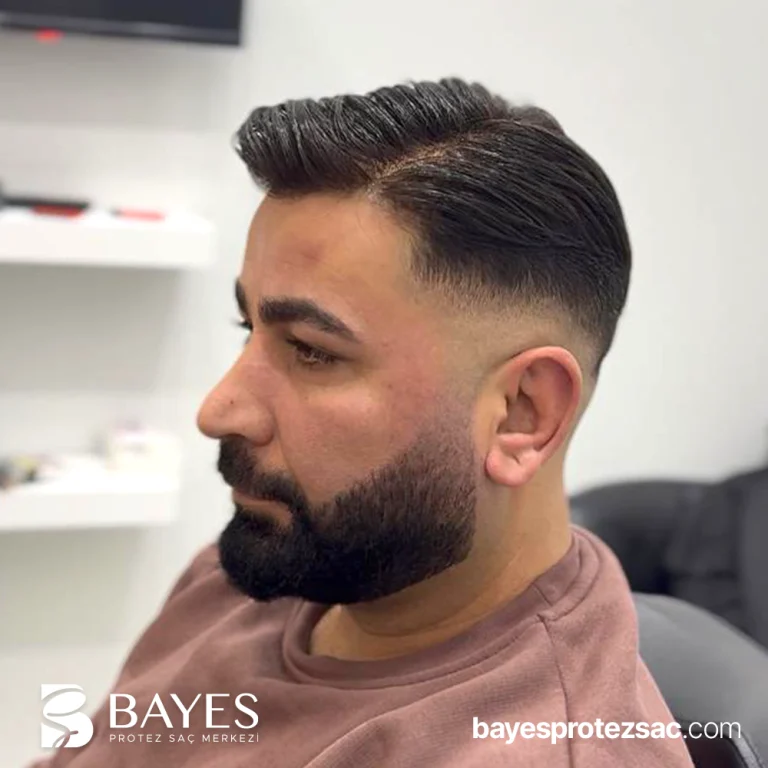 Protez Saç Fiyatları