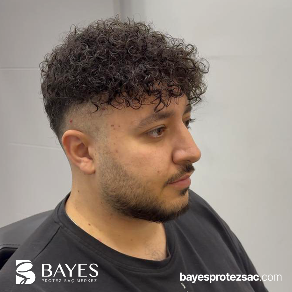 Protez Saç Modelleri 2026