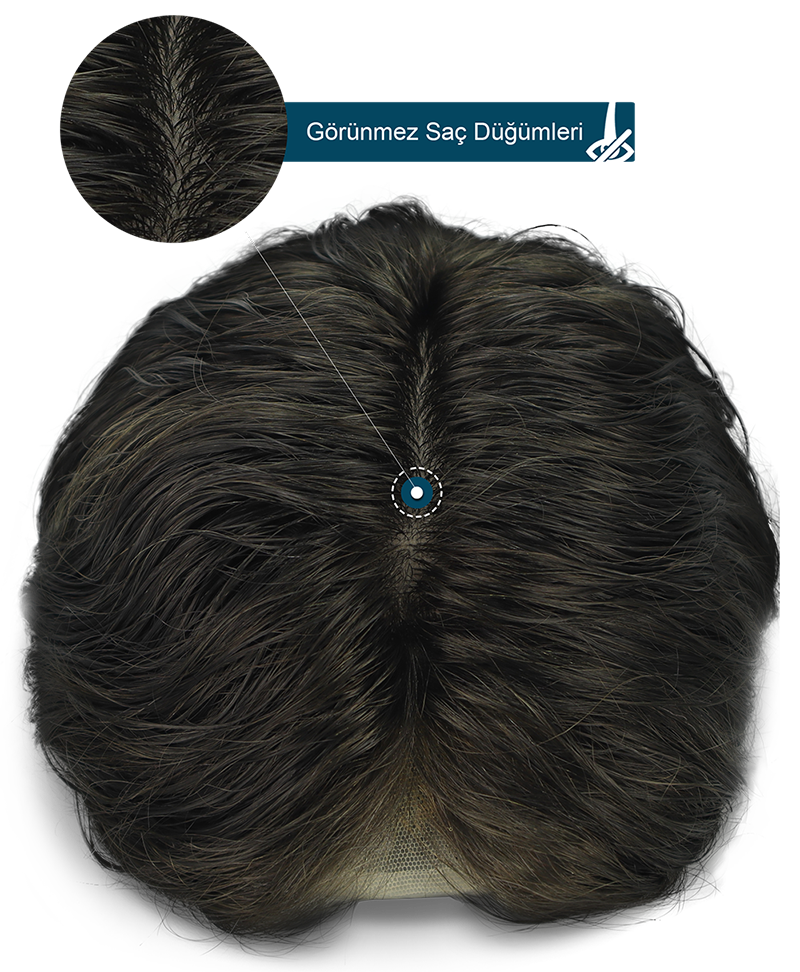 Retouch Modeli Protez Saç